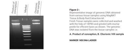 total nucleic acid extraction|Iba pa.